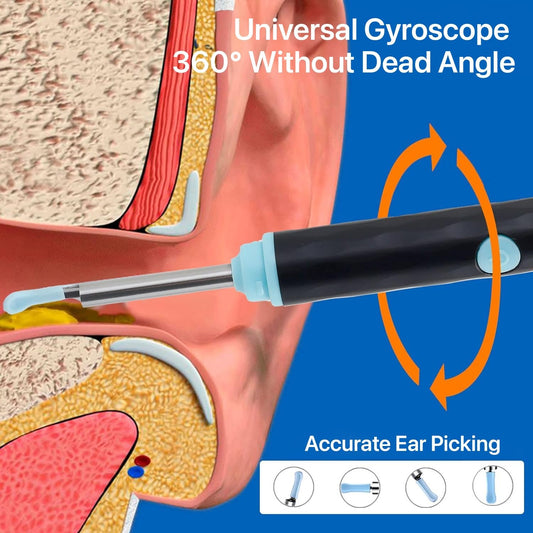 Smart Visual Ear Cleaner with Mobile Display & Camera