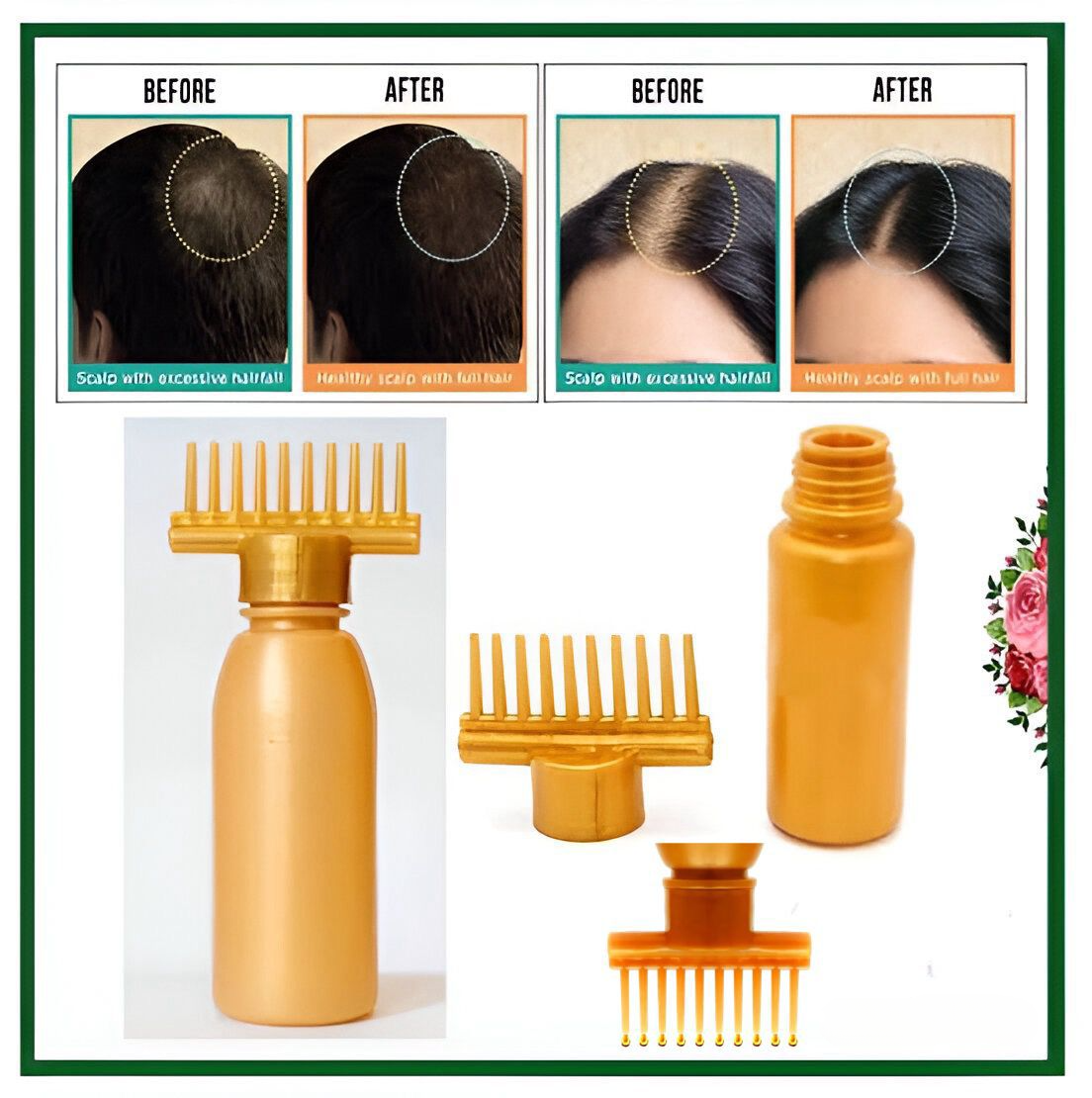 Hair Oil Applicator Comb Bottle (120ml)