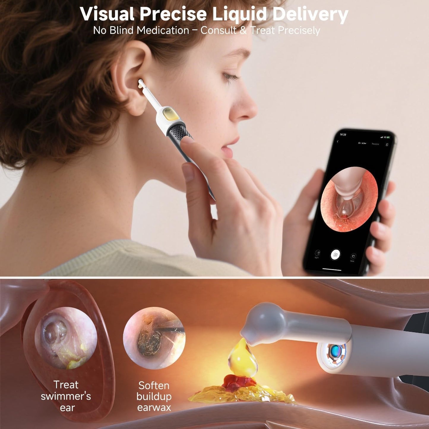 Smart Visual Ear Cleaner with Mobile Display & Camera