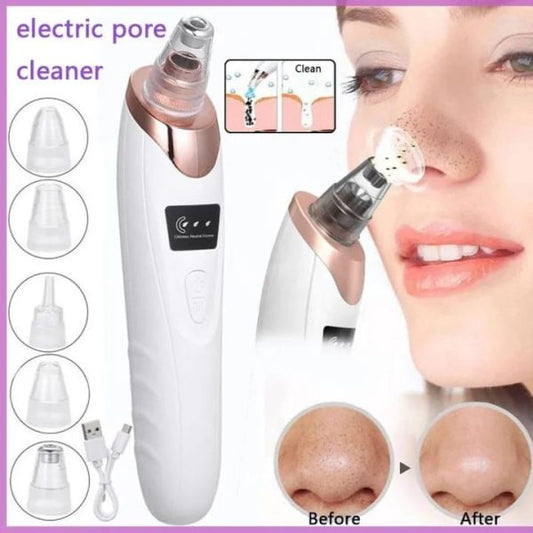 👉 Electric Blackhead Remover Vacuum for Deep Pore Cleansing